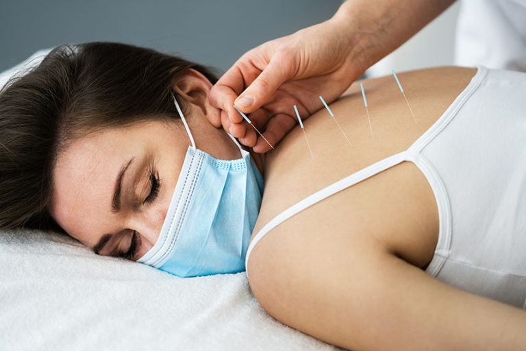 Dry Needling in Gurgaon